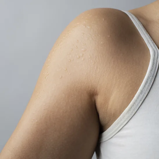 Cellulite on the upper arm